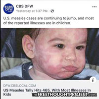 Vaccine injury